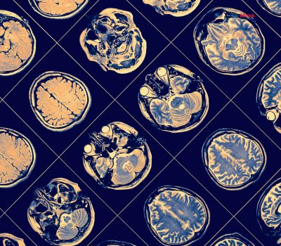 best-neuro-surgery-hospital-in-lucknow